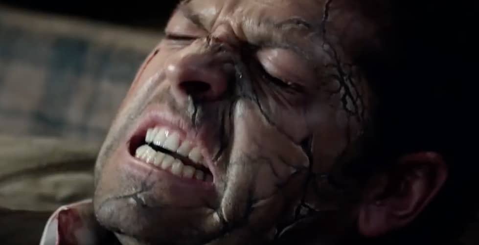 Not looking good for Cas, but he's been through worse right?