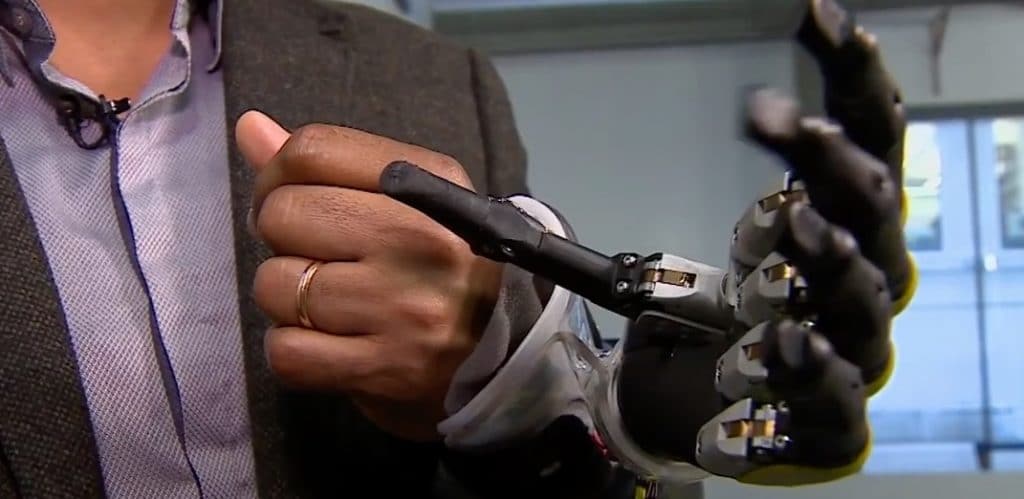 Artificial limb technology is becoming ever more sophisticated