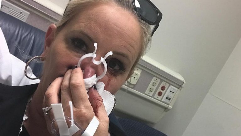 Shannon Beador in hospital with blood on her face and hands