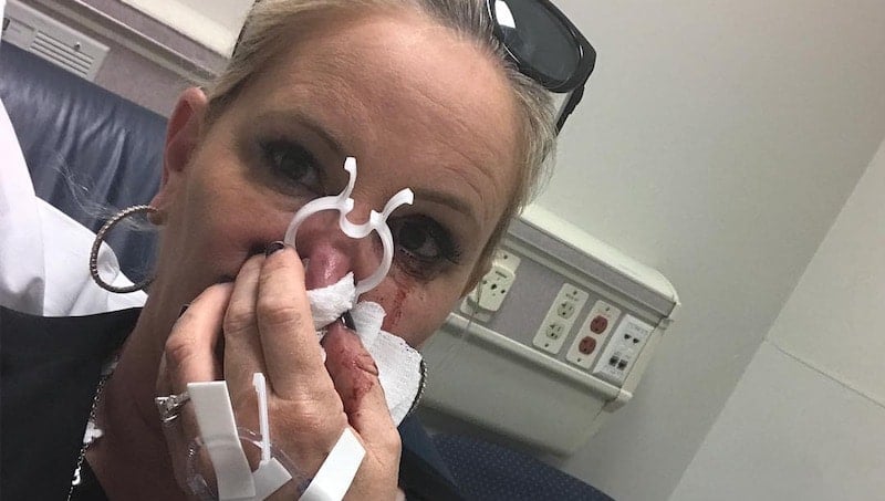 Shannon Beador in hospital with blood on her face and hands
