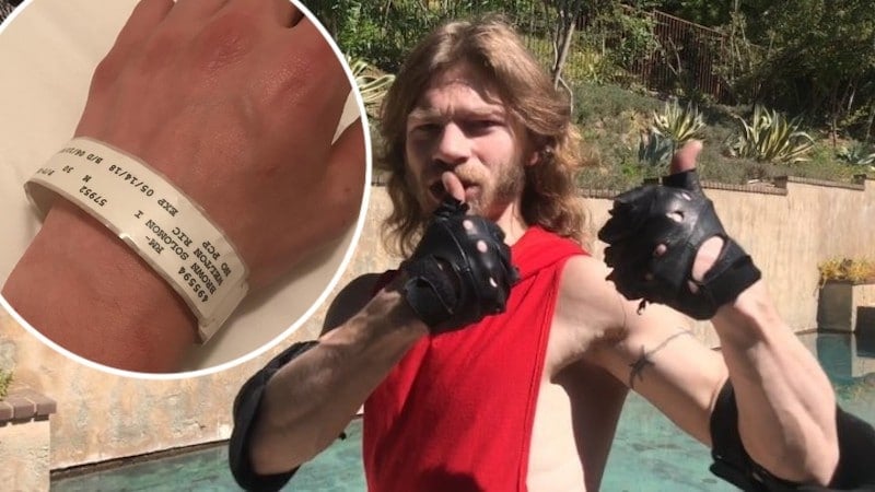 Alaskan Bush People star Bear Brown and a picture of his wrist in hospital