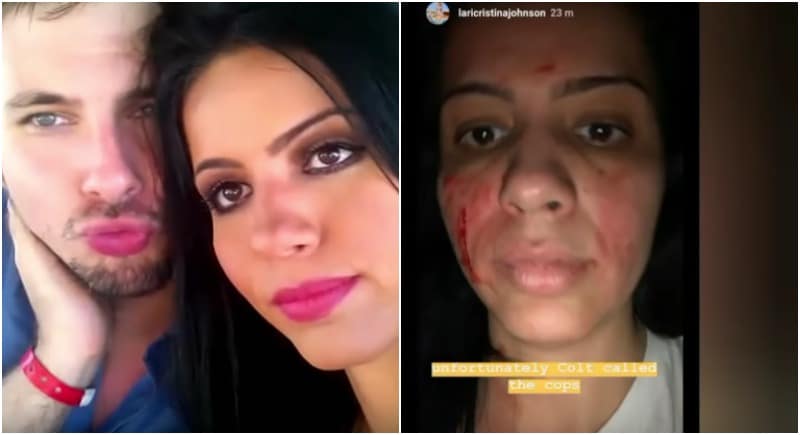 Larissa from 90 Day Fiance with injuries, and with Colt