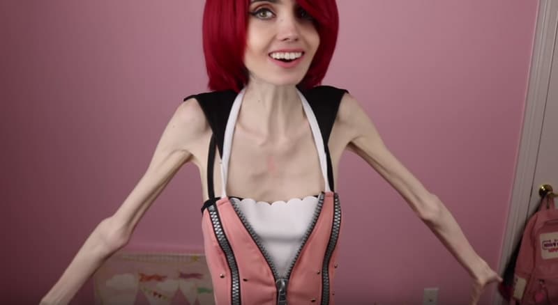 Eugenia cooney anorexia dead
