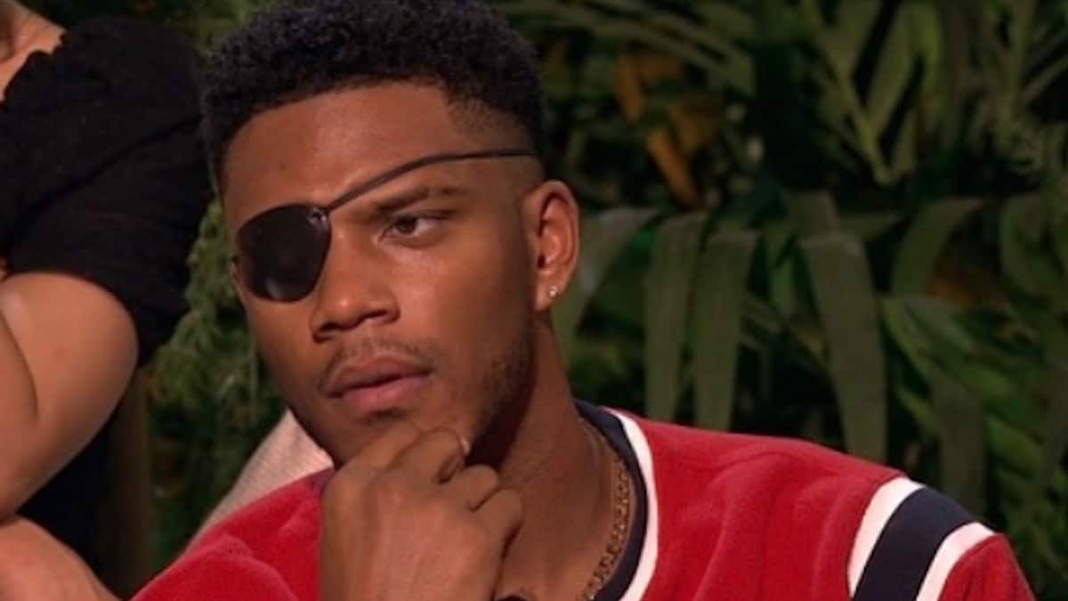 Theo Cambell from The Challenge: How he got his eye injury, latest update