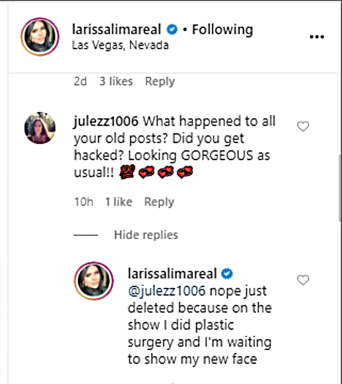 Larissa admits to plastic surgery