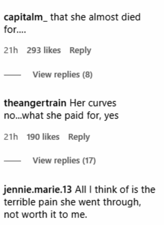 teen mom 2 fans discussed jade cline's surgery on instagram