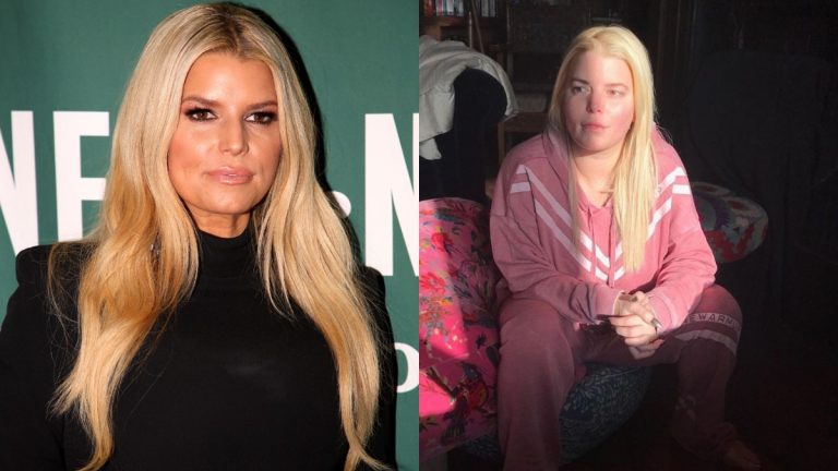 Jessica Simpson on the red carpet and another pic showing the affects of alcohol abuse
