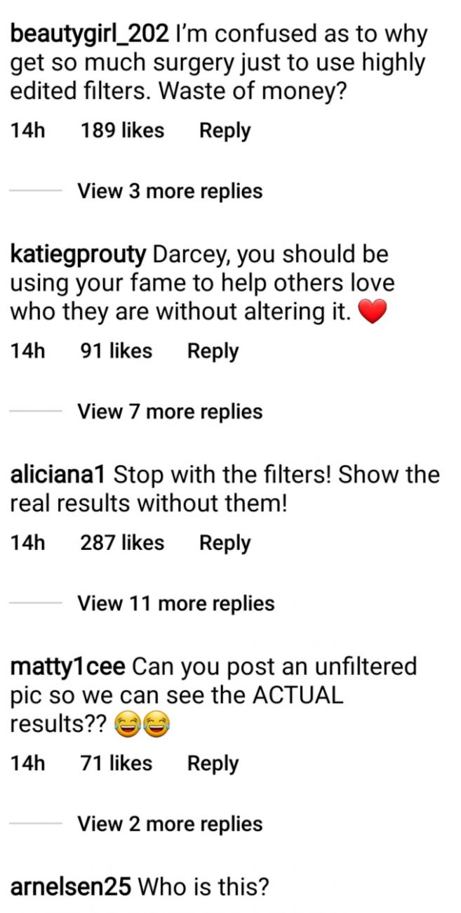 darcey silva's followers commented on her cosmetic work