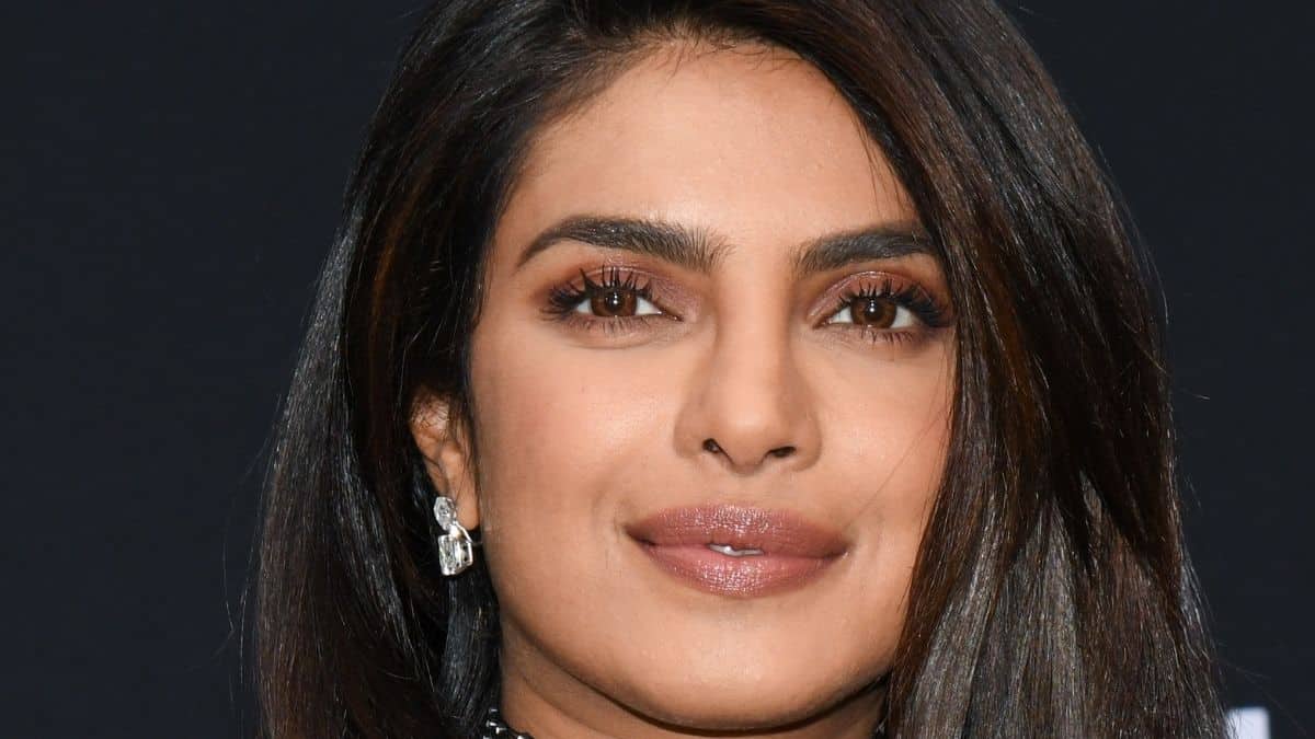 Priyanka Chopra shares pic of bruised and bloody face leaving followers involved