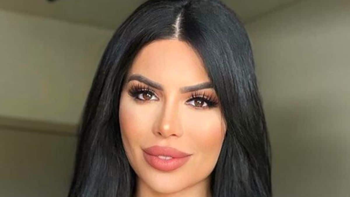 90 Day Fiance alum Larissa Lima says she was botched from a plastic surgery over a year ago.