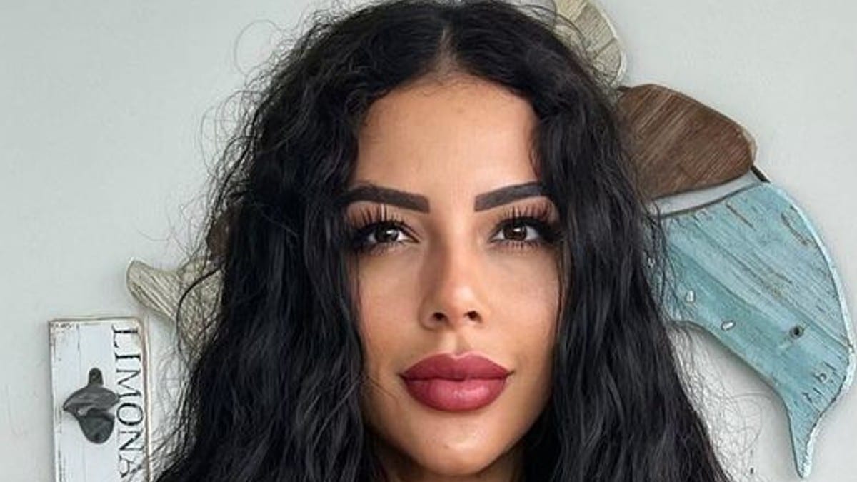 90 Day Fiance: Before the 90 Days star Jasmine Pineda is doing well after undergoing eye surgery.