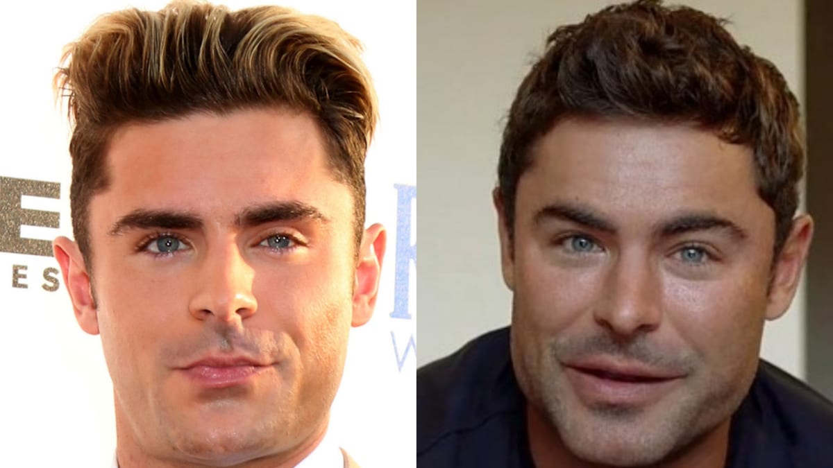 Zac Efron before and after