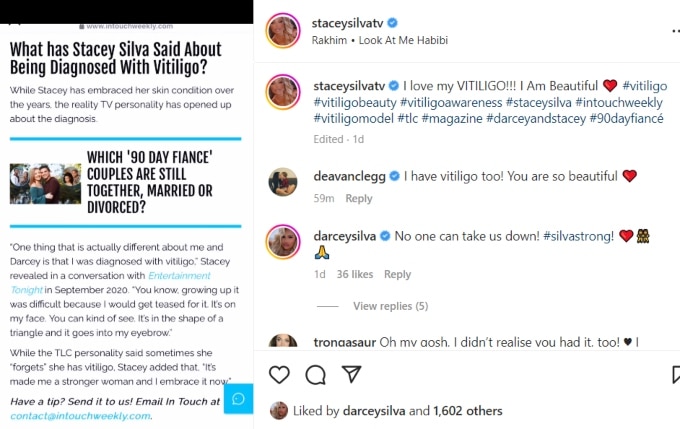 stacey silva opens up about her vitiligo on instagram