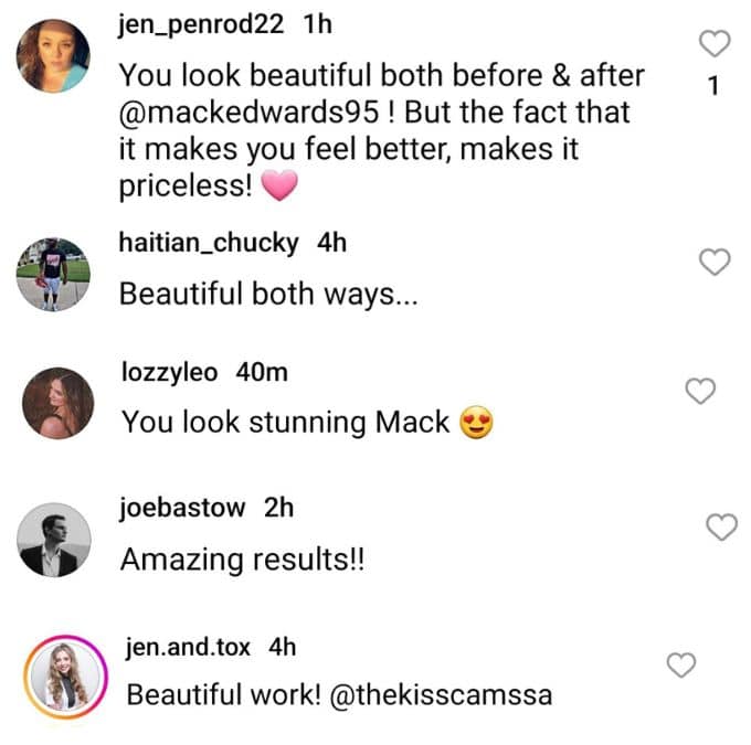 mackenzie edwards' instagram followers comment on her cosmetic work