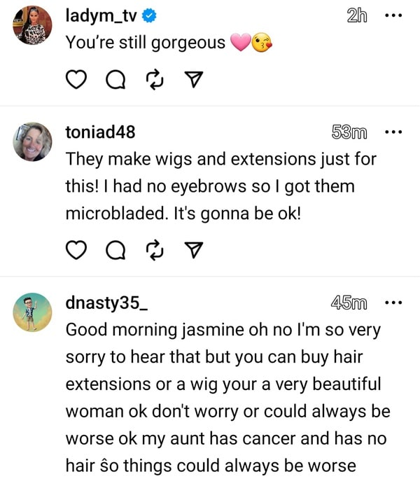 jasmine pineda's threads followers supported her hair loss concerns in the comments section