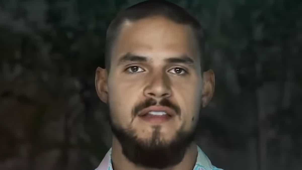 former the challenge winner zach nichols face shot from war of the worlds 2 season
